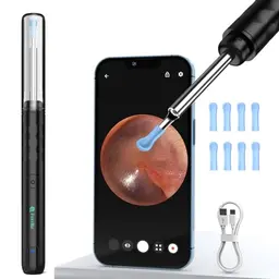 Ohrenschmalz Entferner Otoskop, 1080P WiFi Ohrenreiniger für iPhone und Android (Schwarz)
